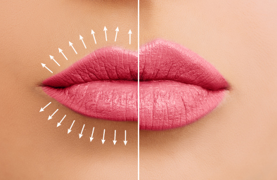 DUNN-Dental-Group-Website-Images_LipLase DUNN-Dental-Group-Website-Images_LipLase